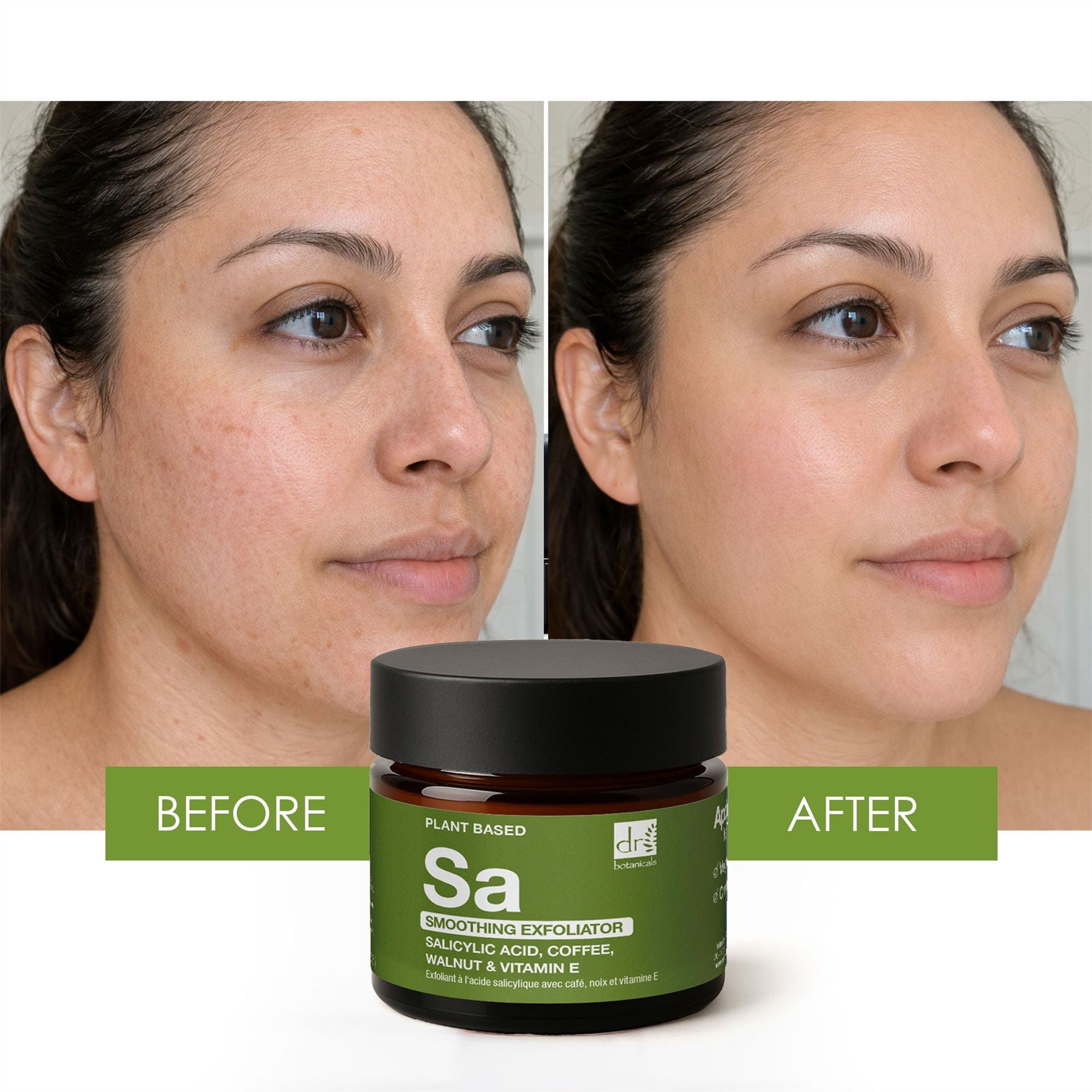 Salicylic Acid Exfoliator with Coffee, Walnut & Vitamin E 30ml
