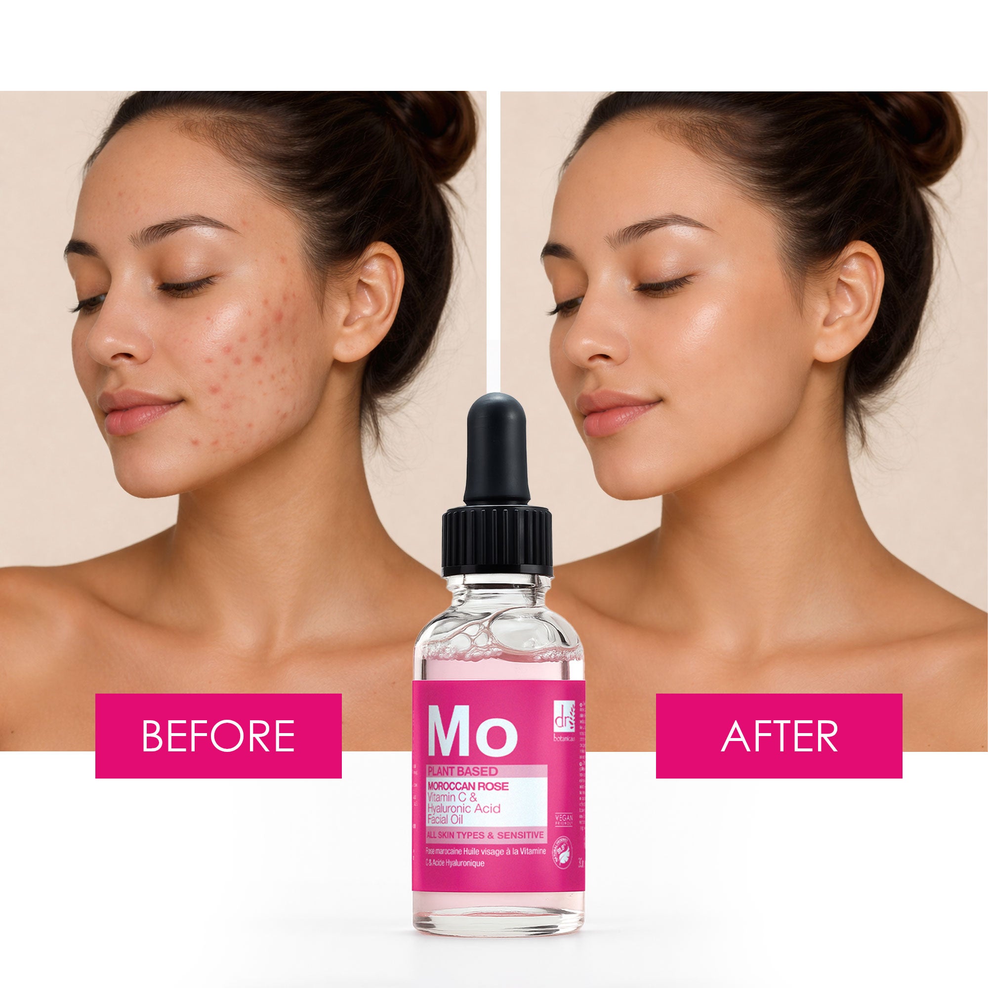 Moroccan Rose Facial Oil with Hyaluronic Acid & Vitamin C 30ml Trio Set